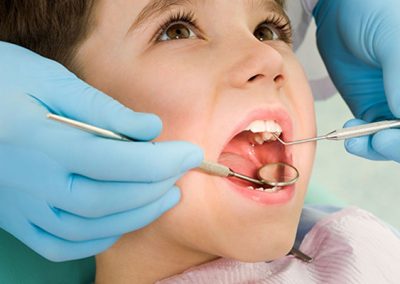 Urgencia dental en Rancagua - Centro de Especialidades Odontológicas