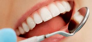 Urgencia dental en Rancagua - Centro de Especialidades Odontológicas